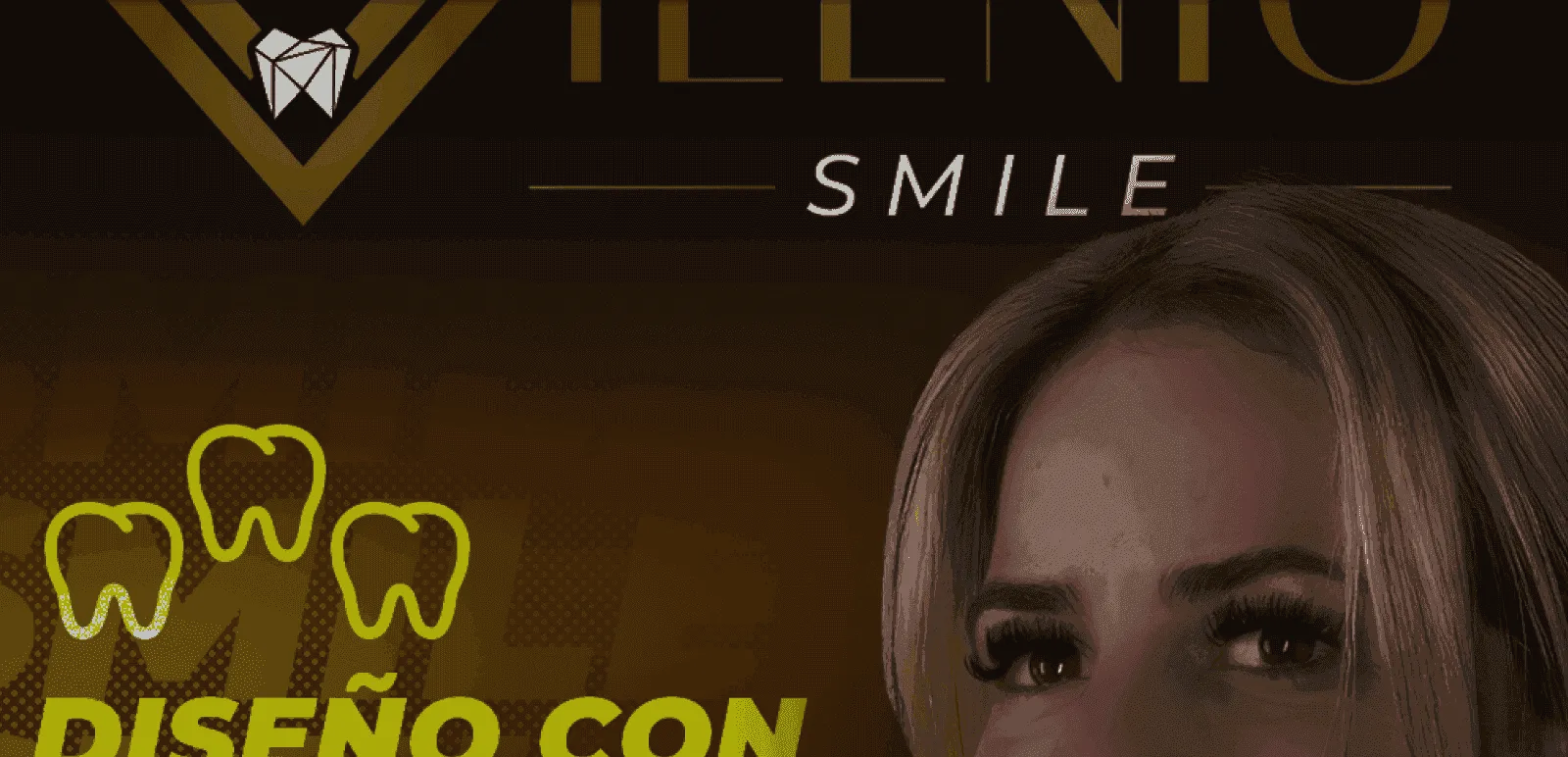 Milenio Smile, detalle 4